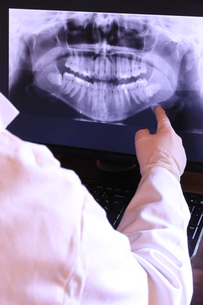 Best Emergency Tooth Extraction in Rice, MN